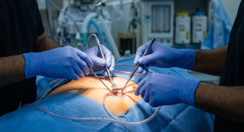 Open & Minimally Access Surgery