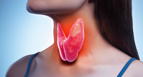 Thyroid Surgery